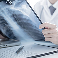 Gesundheitsreform